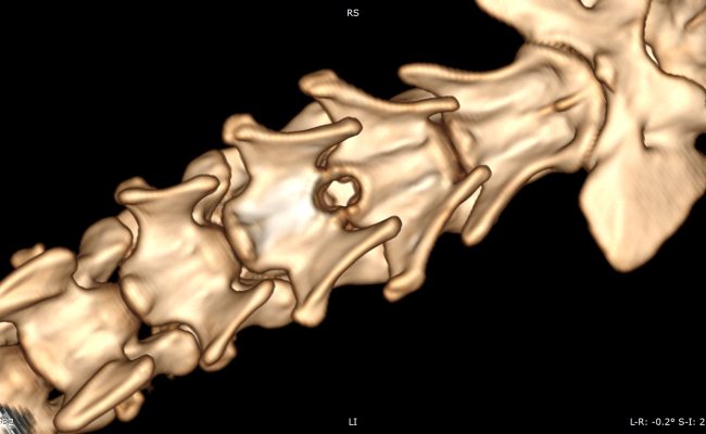 3D_VR_-_hirault_ula_-_14_11_2025_21_25_01_-_TISSUS_MOUS_RACHIS_1.0_0000